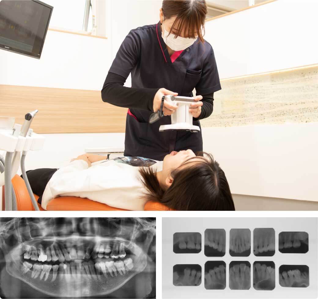 患者さんの歯のレントゲンをとっているところと実際のレントゲン
